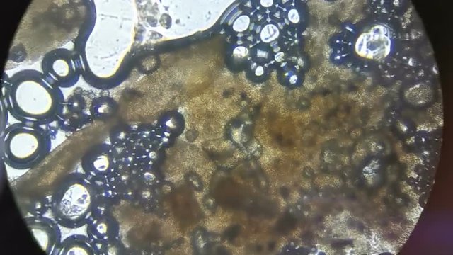 Cells under the microscope