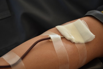 Blood donation