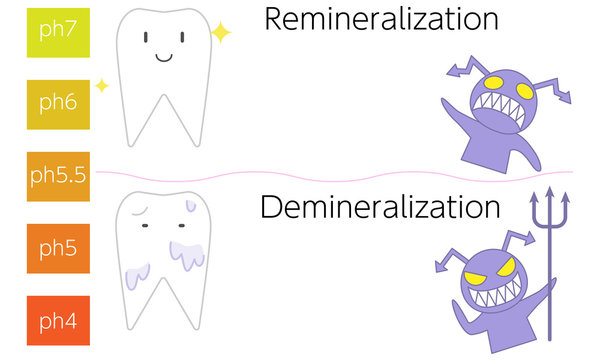 再石灰化と脱灰のpH値による歯と虫歯菌のイメージイラスト