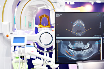 Dental digital tomograph