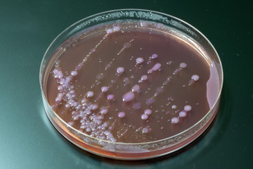 bacterial colonies   on  agar   medium petri dish plate plate on MacConkey agar