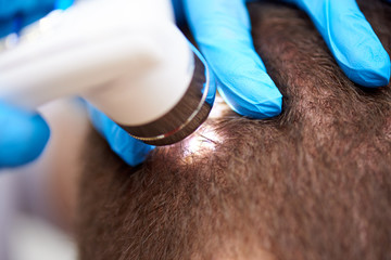 Microscopic examination of the hair and skin of the scalp.