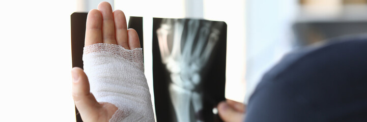 Male bandaged hand holds xray image closeup. Injury and sprain treatment concept