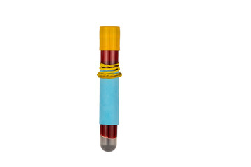 glass medical test tube for blood tests on a white background. The concept of preventing the spread...