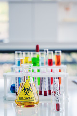 covid-19 infected blood sample in sample tube in laboratory