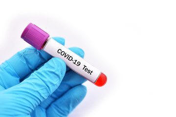 Obraz premium Test tube with blood sample for COVID-19 test, novel coronavirus 2019 found in Wuhan, China