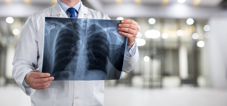 Doctor holding radiography x ray photo on hospital background