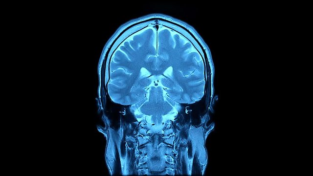 MRI scan. Human brain.