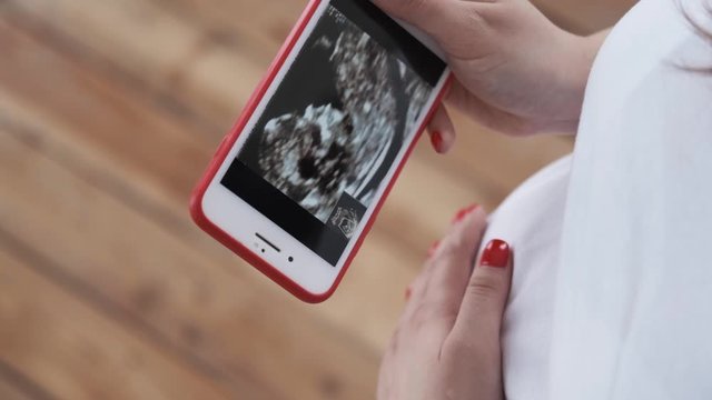 Pregnant woman with her ultrasound photo on smartphone, belly closeup