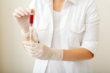 Blood test in tube for laboratory analysis in doctors hand. Laboratory analysis, biochemical blood...