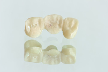 The effect of long​ zirconia ​bridge​  before​ fixing to the patient with a reflection on the glass.