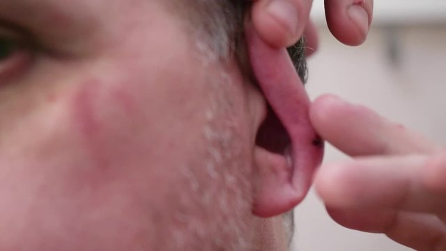 Caucasian man examines bruise in his ear in mirror. Extreme Close-up