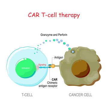 T-cell with Chimeric antigen receptor (CAR t cell) killing of the tumor cell.