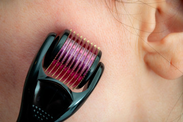 Mesotherapy or microneedle therapy, wrinkle prevention and acupuncture procedures to prevent...