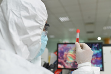 Asian male doctor wearing protective suits holding a positive blood test result for the new rapidly spreading Coronavirus (nCoV, Covid-19). International standard biological laboratory concept.