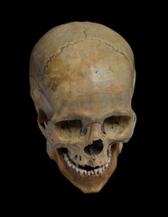Skull of the human