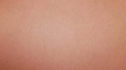 Pattern of baby skin