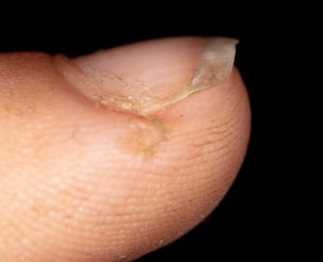 Nails with dirt on the finger