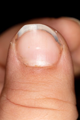 Nails with dirt on the finger