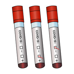 Blood test for inflammation. Vector set. Isolated background. Diagnostics of blood samples for coronavirus infection COVID19. Tubes with patient analyzes. Three results. Collection of clinical samples