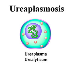 Ureaplasma urealyticum. Bacterial infections Ureaplasma. Sexually transmitted diseases. Infographics. Vector illustration on isolated background.