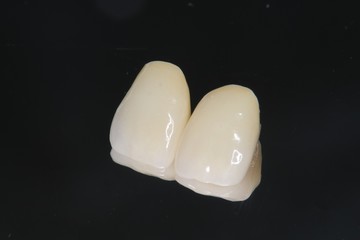 審美歯科　セラミッククラウン