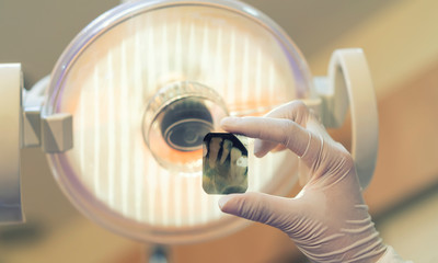 The woman put a kit of dentist's helper, hold the X-ray film and watch the film of the patient in the dental clinic.