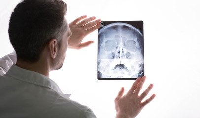 doctor examining patients x-ray and MRI scans. Human Head Sinusitis