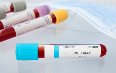 coronavirus positive test tube. ncov positive blood sample