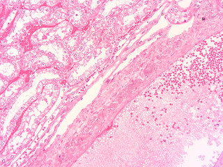 picture of histology human tissue with microscope from laboratory (not Illustration Designation)