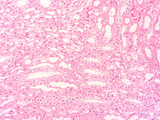 picture of histology human tissue with microscope from laboratory (not Illustration Designation)