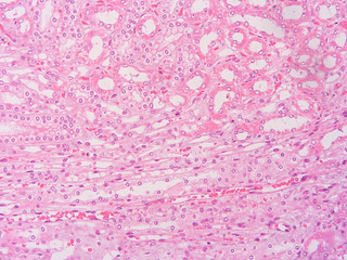picture of histology human tissue with microscope from laboratory (not Illustration Designation)