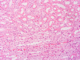 picture of histology human tissue with microscope from laboratory (not Illustration Designation)