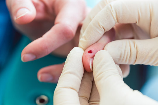 Nurse squeezing drop of blood out of patient finger for diabetes test