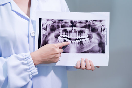 Close up woman dentist holding patient mouth digital film.Female doctor showing patient oral scan.The dentist explained about the oral cavity to the patient at the dental office in the hospital.