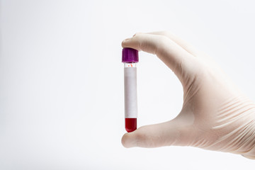 Hand of laboratory assistant holding test tube with blood sample on white background