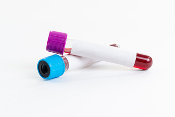Test tubes with blood samples on white background.