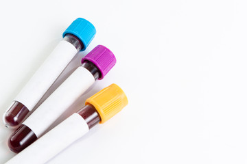 Test tubes with blood isolated on white.