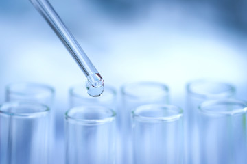 The researchers tested antibiotics in a glass tube in a hospital lab.