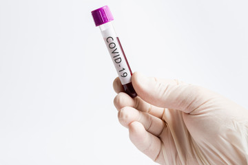 Obraz premium Hand holding blood in test tube close up. COVID-19.