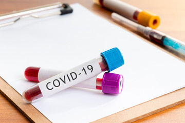 Clinical work table with blood test tubes and syringe. COVID-19.