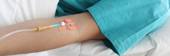 Focus on males hand with intravenous injection of catheter. Serious life state of person and emergency aid. Healthcare for patient lying in hospital bed