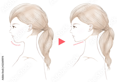 若い女性 二重あご ビフォーアフター Wall Mural Wallpaper Murals 桜 マチ