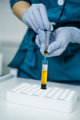 beautician is gaining blood in syringe from tube test