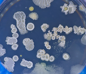 Tests for skin fungal diseases. Samples of fungus causing skin diseases grown in a petri dish