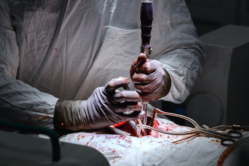 Surgery on chest, cardiac replacement, cardiology, surgeon sets clamp and stretch for ribs