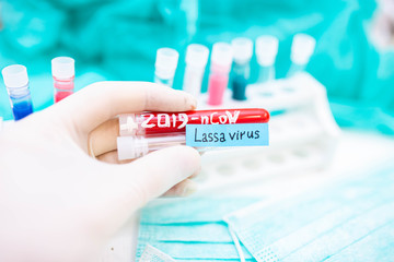 2020 epidemic test tubes with Lassa fever and coronavirus,