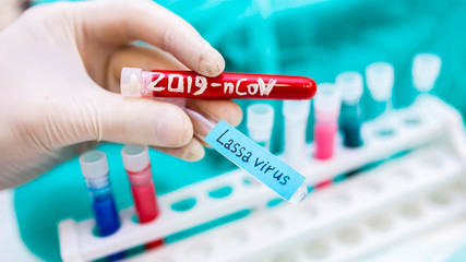 2020 epidemic test tubes with Lassa fever and coronavirus,