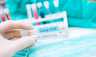 2020 epidemic test tubes with Lassa fever and coronavirus,