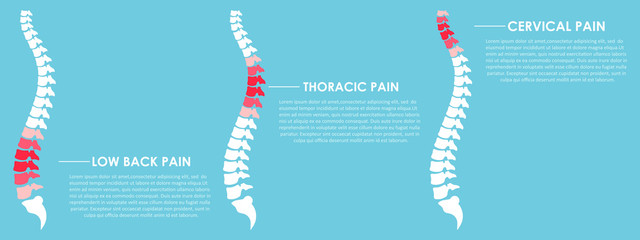 Spine pain vector design illustration
